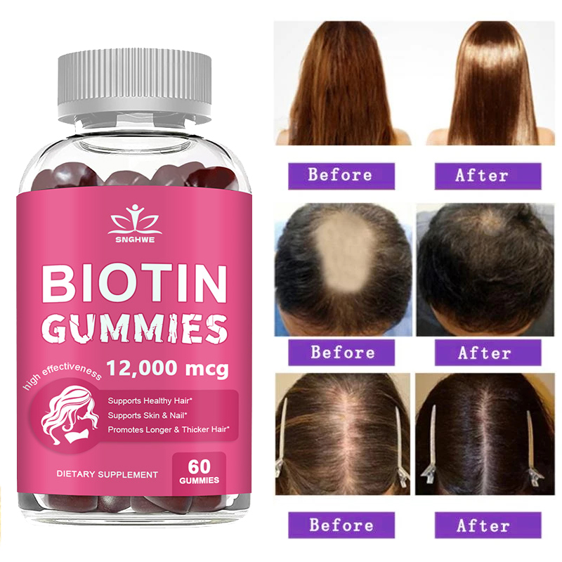 Collagen Gummies Biotin Gummie - Hair Care Gummies review and price